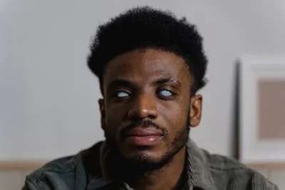 HAVING A HARD FOREHEAD.